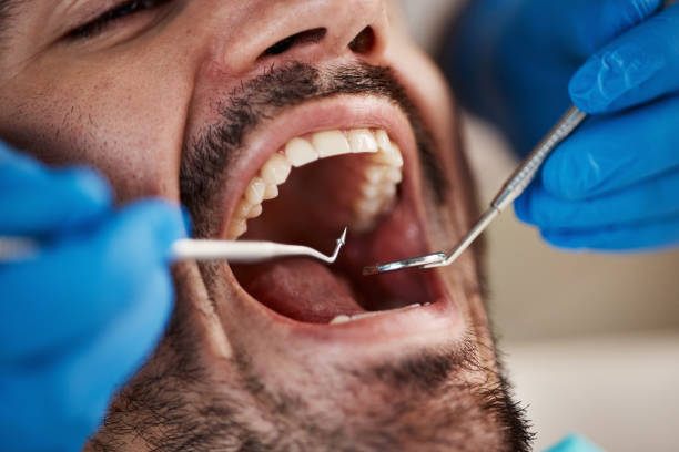 Emergency Dental Services in Cheverly, MD